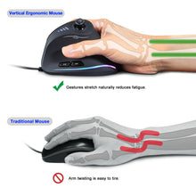 Carregar imagem no visualizador da galeria, Mouse ZELOTES Vertical Gaming Wired RGB